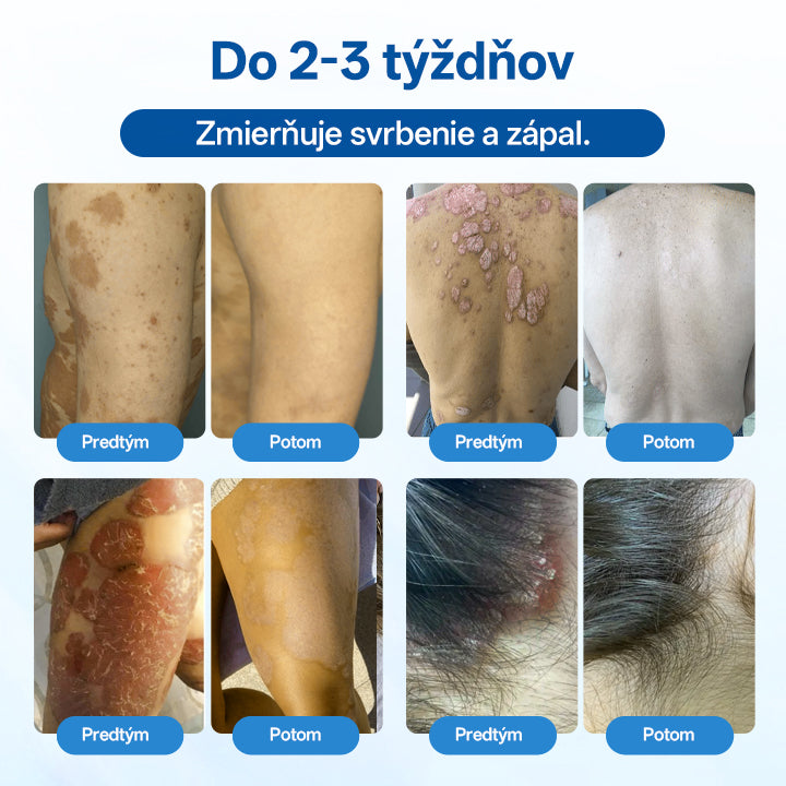 Zyrelvo®🌲 Horčíkový bylinný liečebný sprej