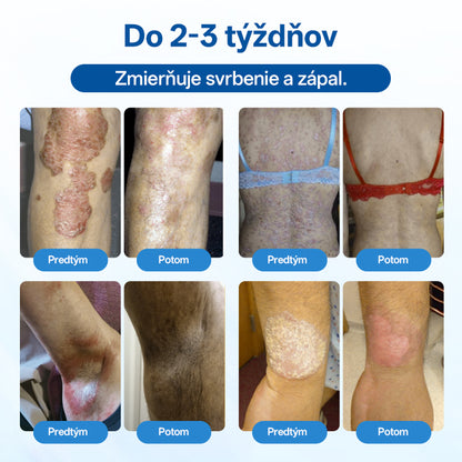 Zyrelvo®🌲 Horčíkový bylinný liečebný sprej