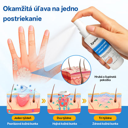 Zyrelvo®🌲 Horčíkový bylinný liečebný sprej