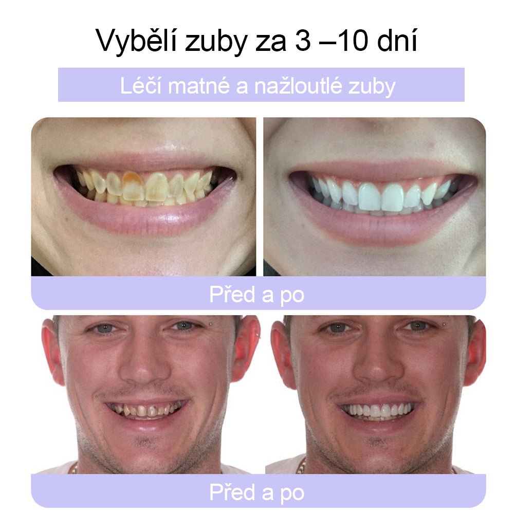 🦷🦷CleraNature® Zubní minerální prášek na obnovu zubů🔮