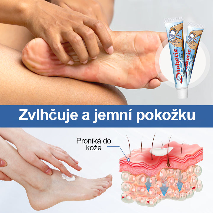 Zyrelvo® Diabetický ošetrujúci krém