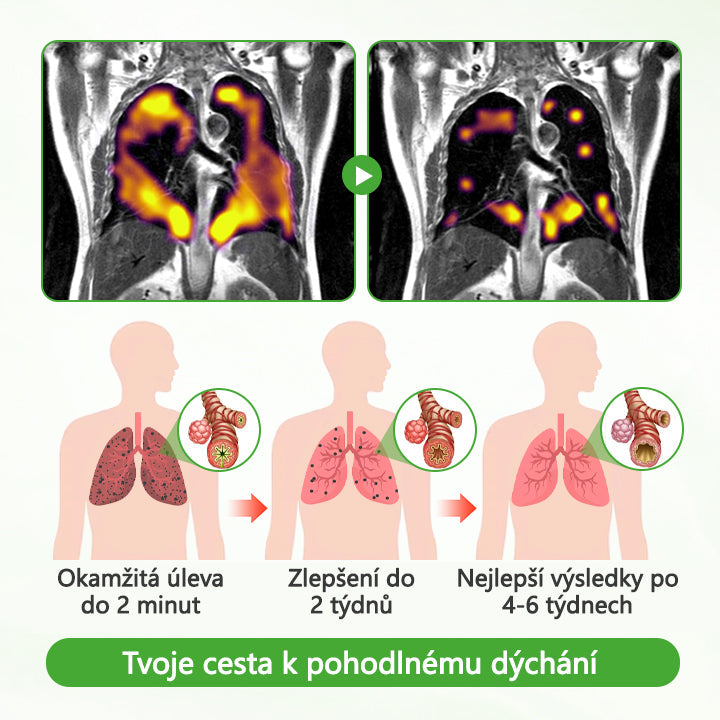 🏅CleraNaure® HerbaAir Mullein Čistič Plic