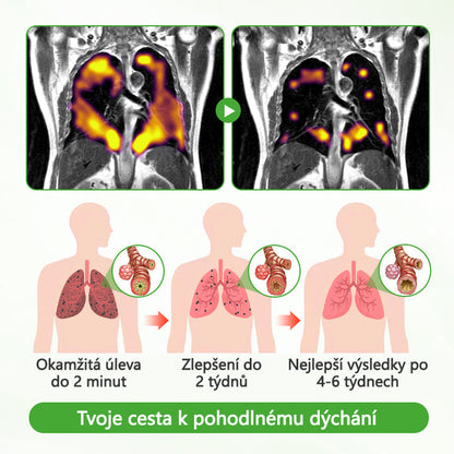 🏅CleraNaure® HerbaAir Mullein Čistič Plic