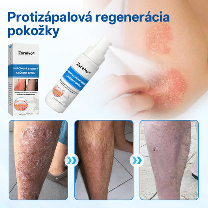 Zyrelvo®🌲 Horčíkový bylinný liečebný sprej