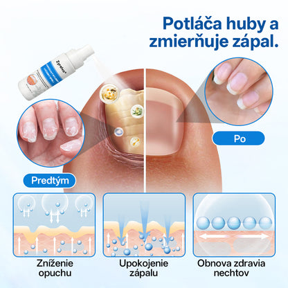 Zyrelvo®🌲 Horčíkový bylinný liečebný sprej